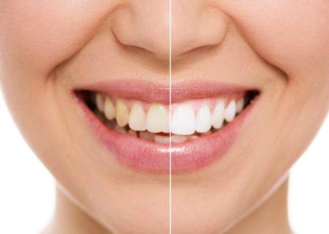 Здоровье зубов без страха: современный подход к стоматологии