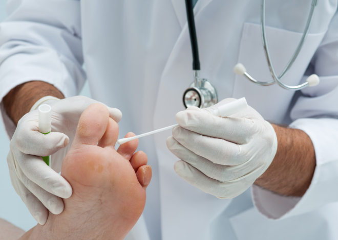 Лікування грибка нігтів: що справді працює