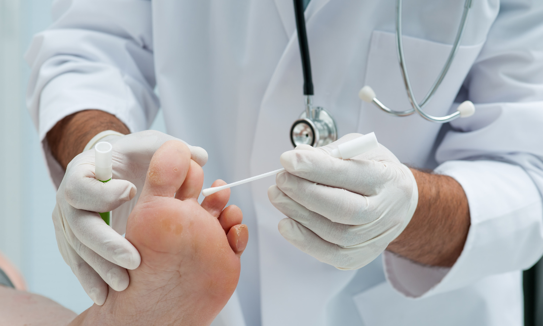 Лікування грибка нігтів: що справді працює